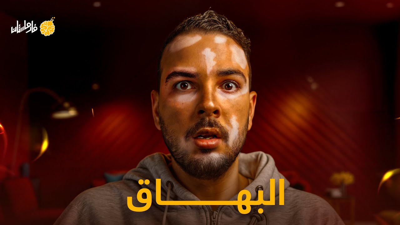 فارماستان - البهاق