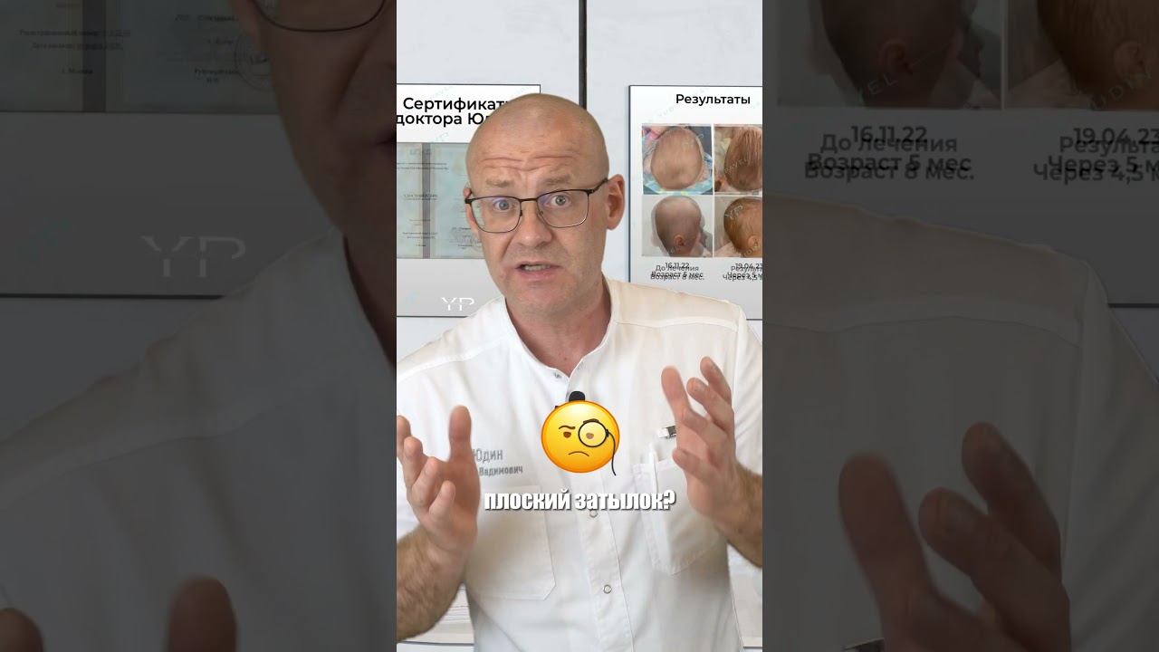 Плоский затылок у ребенка - это не норма! #врек #реки #рекомендации #плоскийзатылок #ортотис