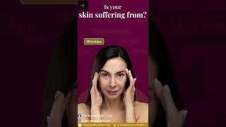The Ultimate Solution for Acne, Pigmentation &amp; Fine Lines | Vibrant Aesthetic Care #beauty