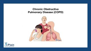 Chronic Obstructive Pulmonary Disease - COPD