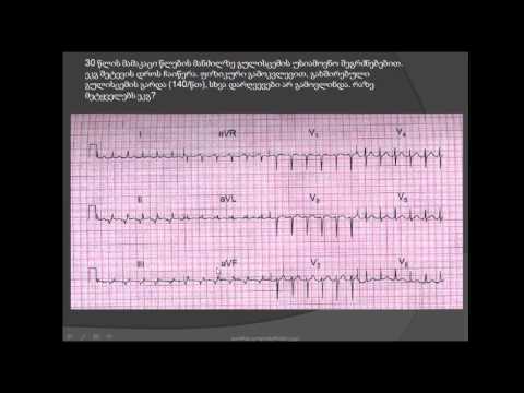 ეკგ. წინაგულოვანი ტაქიკარდია (winagulovani taqikardia, atriuli taqikardia). ადენოზინი (adenozini)