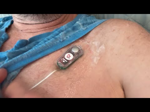 This is a temporary heart monitor. The VA has put me on.