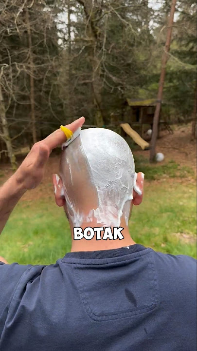 Cara Orang Botak Merawat Kepala Biar Tetap Mengkilap!