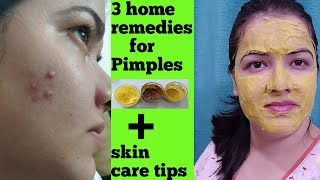 Remove pimples with home remedies. Three natural home remedy for pimples.|Sadaf|