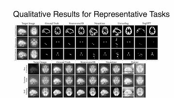 Neuroverse3D: Developing In-Context Learning Universal Model for Neuroimaging in 3D