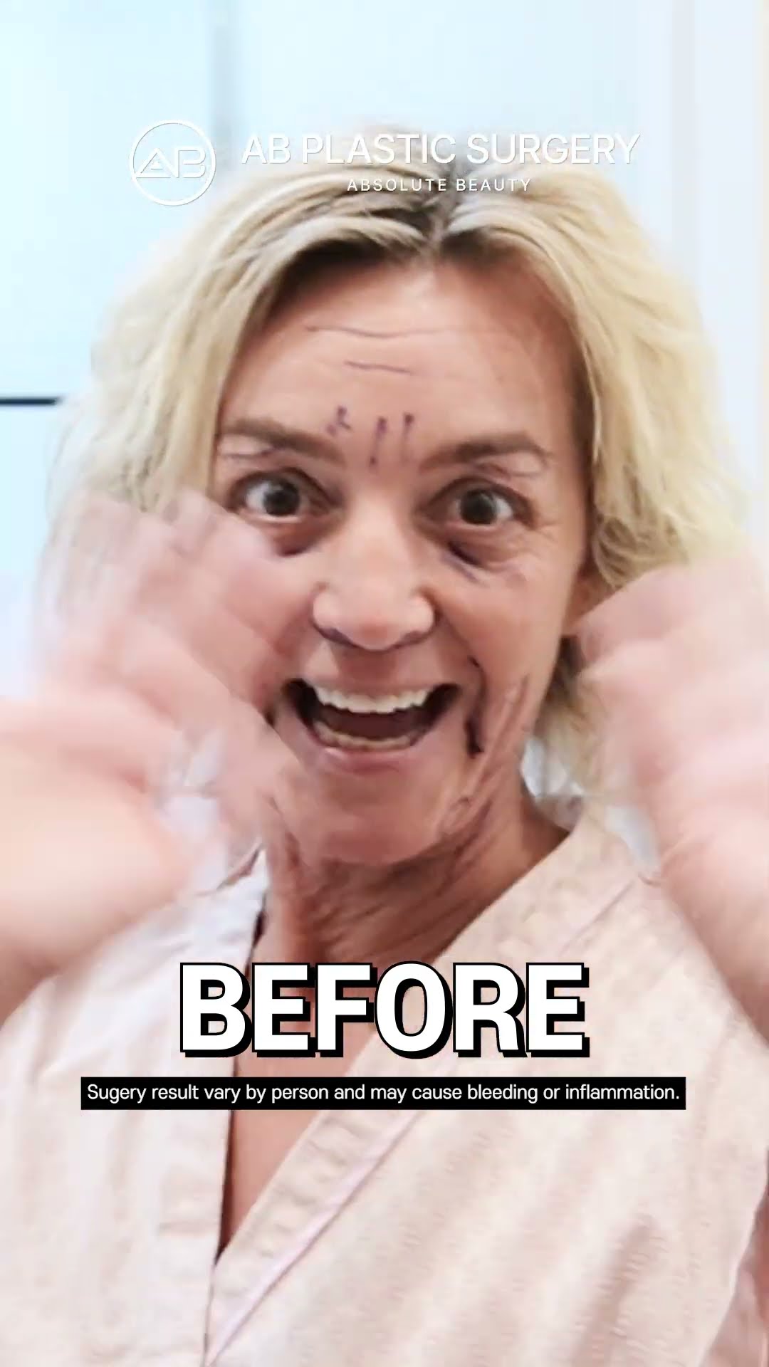 Quick Fix or Life-Changing Surgery in Korea #shorts
