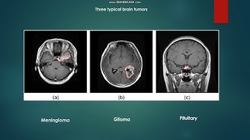 Brain Tumor Classification using ML and CV