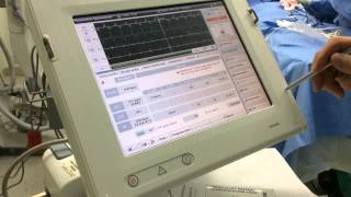 Induction 2