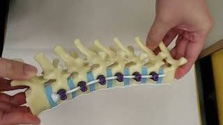 Vertebral Body Tethering (VBT)