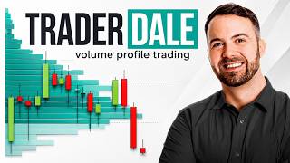 Trader Dale | Volume Profile Trading