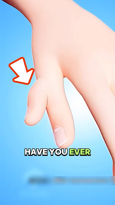 The Truth Behind Extra Fingers or Toes