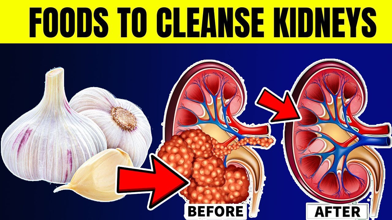 10 Foods That Will CLEANSE Your Kidneys FAST! - YouTube