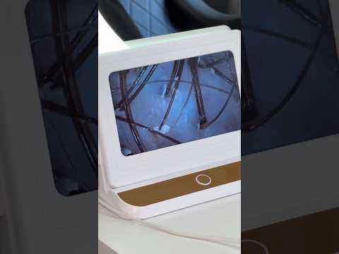 Трихоскоп Premium, видео 2