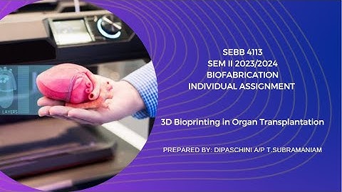 3D Bioprinting in Organ Transplantation
