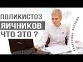 Поликистоз яичников, что это? Три основных симптома. акушер-гинеколог Екатерина Волкова.