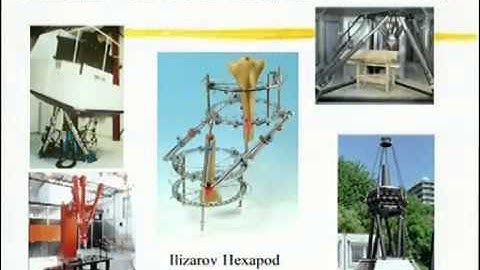 Six Axis deformity correction: Hexapod fixator