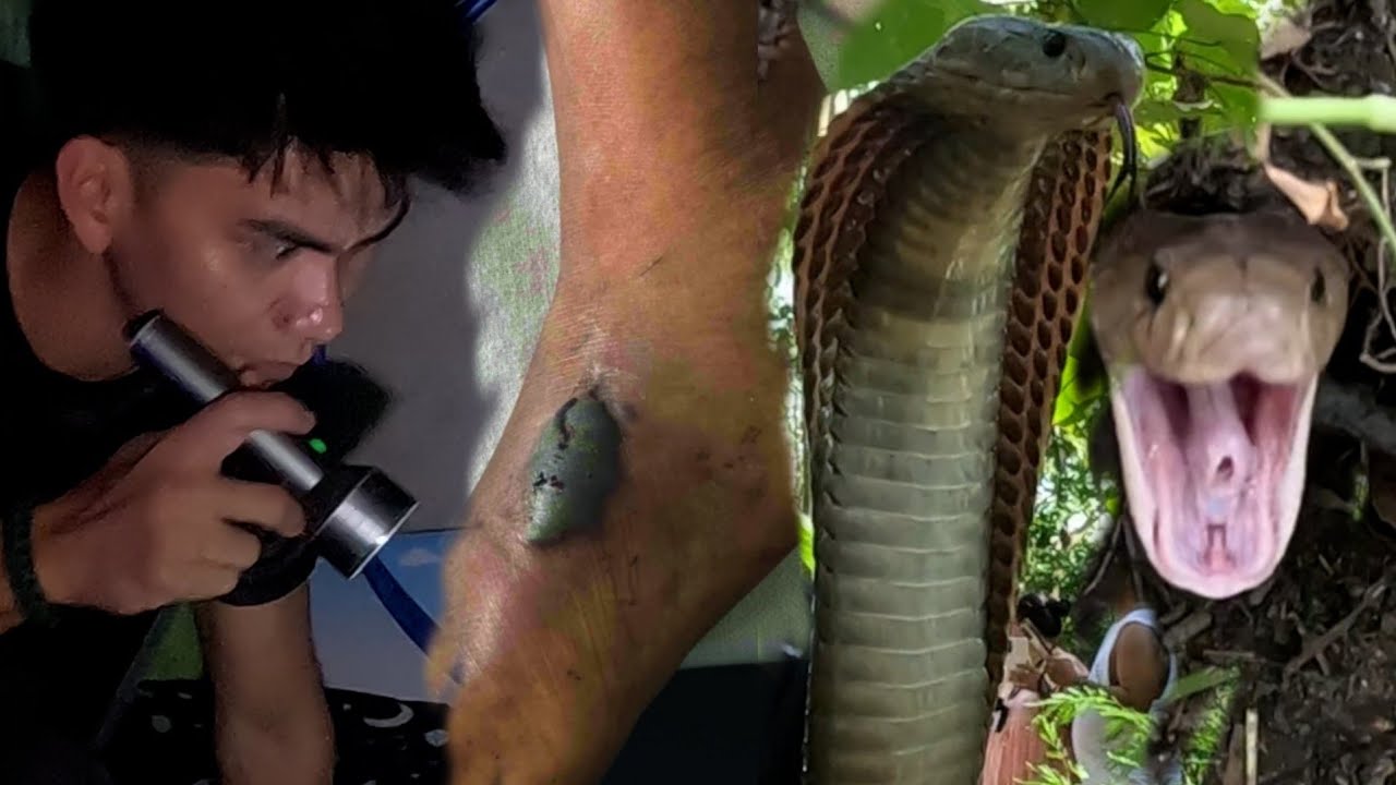 TINUKLAW NG GALIT NA COBRA SI TATAY DANNY SA PAA