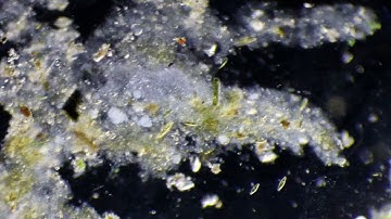 A Look At Diatoms Through a Swift Sw380t microscope (Oblique illumination and bright field)