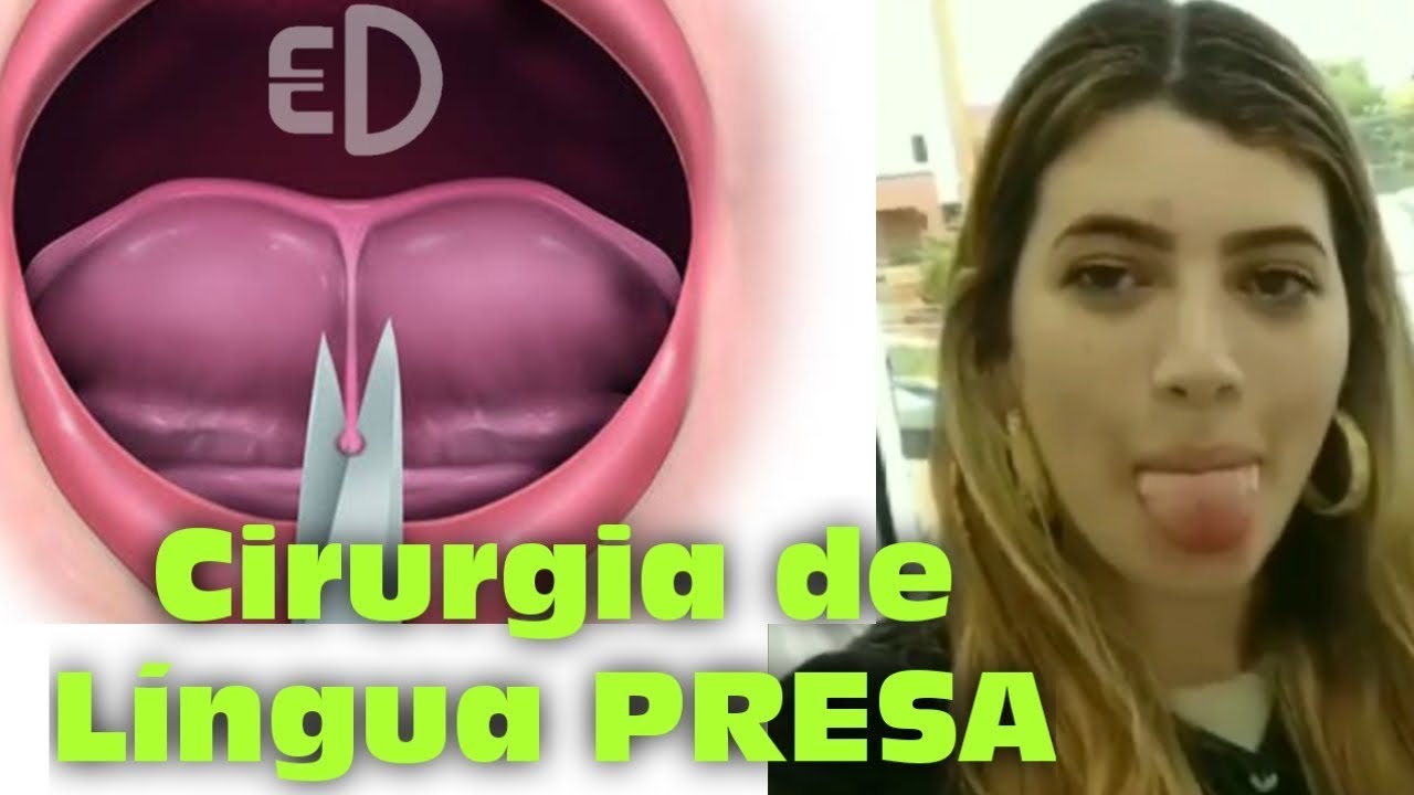 Corte Profundo Na Língua - FDPLEARN