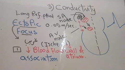 CVS new system (Conductivity) dr mohamed fayez