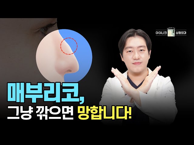 매부리코 교정! 무조건 깎는건 안된다고?!│아이니크성형외과│공유택원장님
