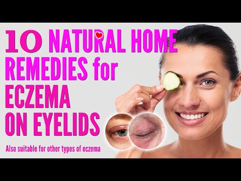 10 Best Natural Home Remedies for Eczema on Eyelids | how to treat eczema eyelids 2021