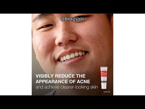 Neutrogena Rapid Clear Acne Spot Treatment Review: Does It Really Reduce Pimples in 2 Hours?