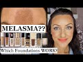 MELASMA?? Which Foundations Cover It?