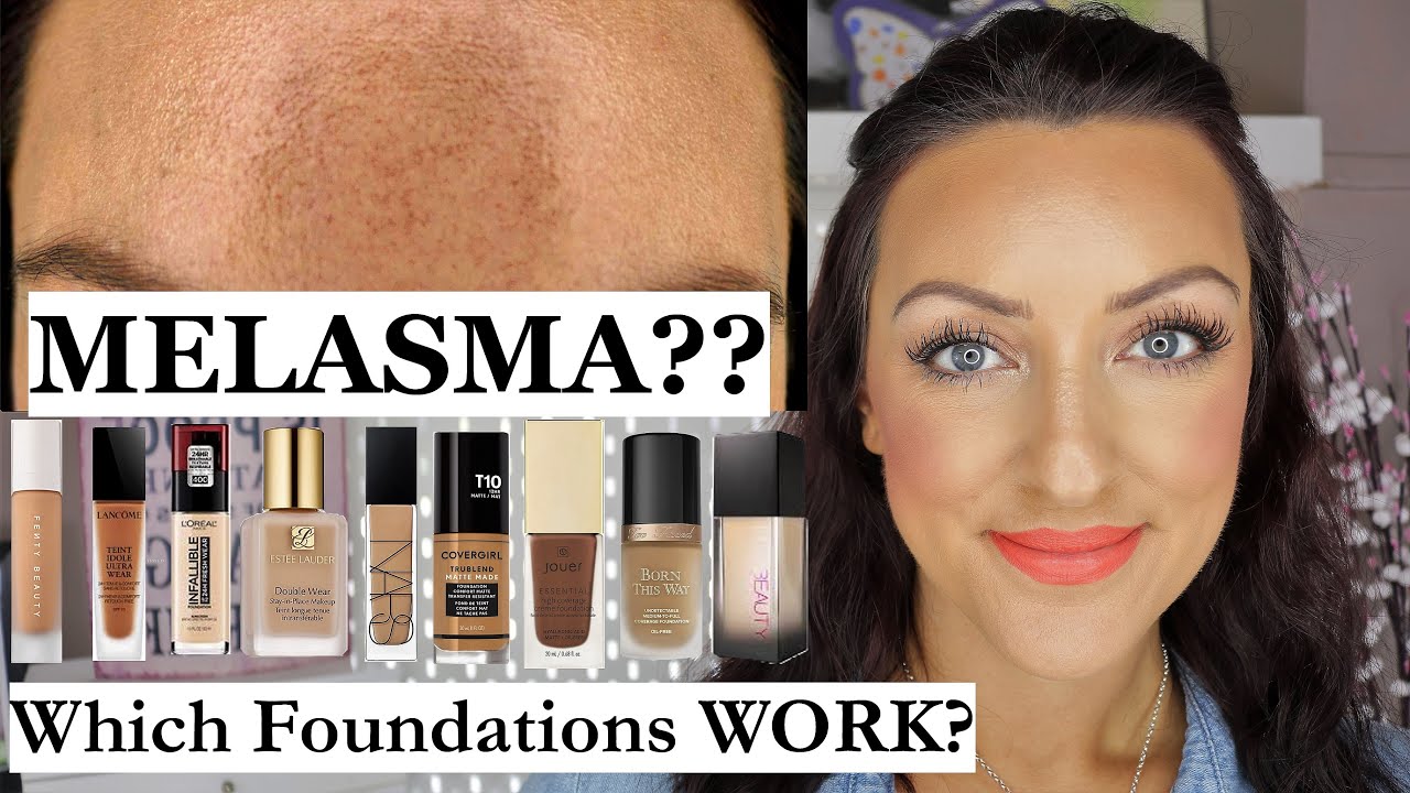 Synslinie tang faktor MELASMA?? Which Foundations Cover It? - YouTube