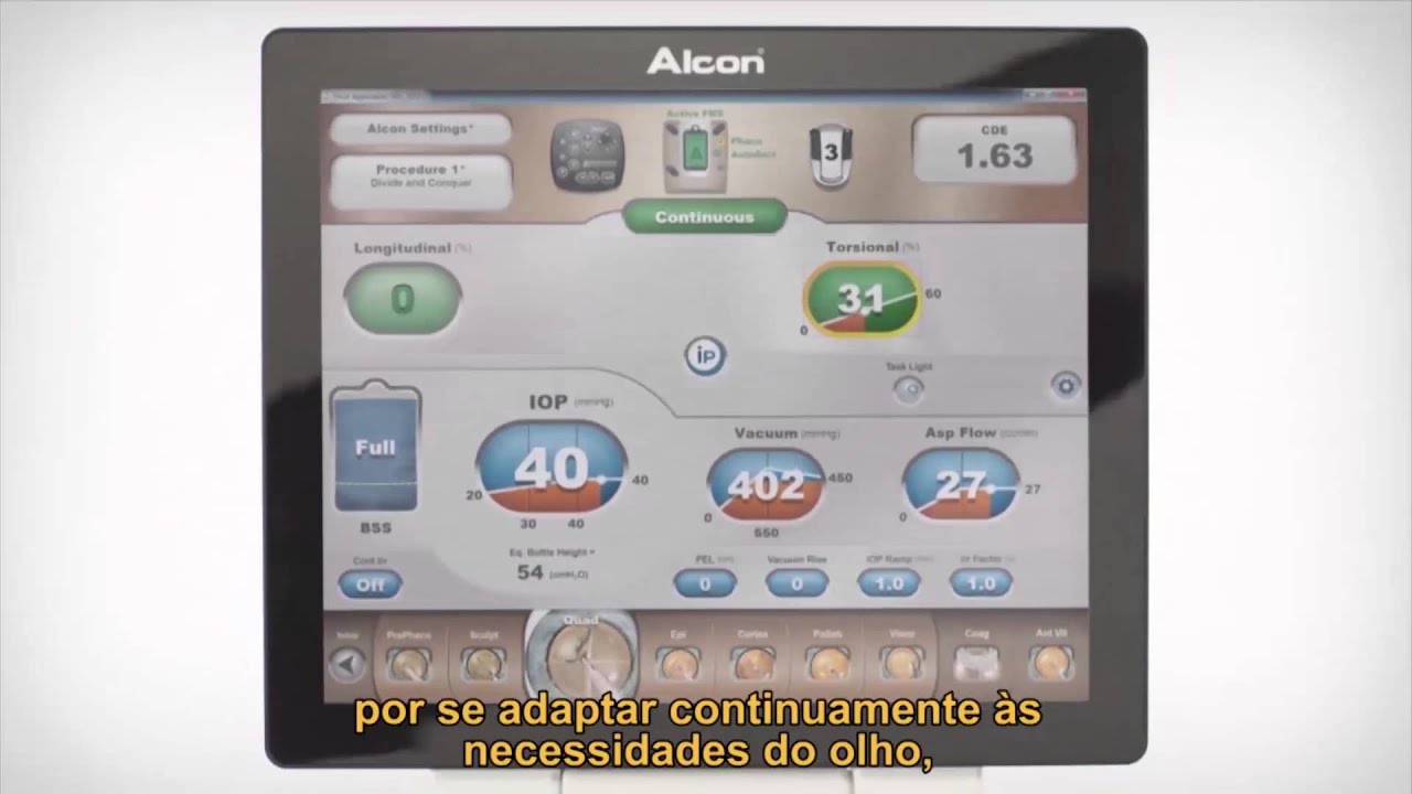 Факоэмульсификатор alcon centurion инструкция
