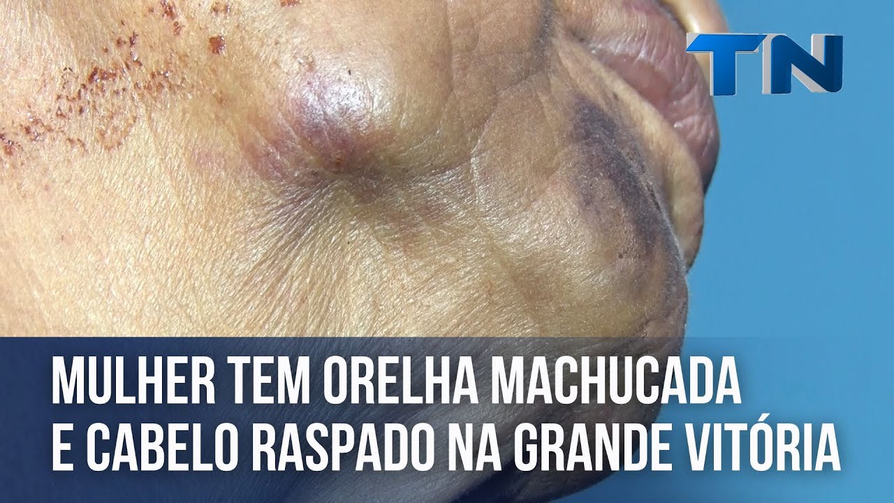 Mulher tem orelha machucada e cabelo raspado na Grande Vitória