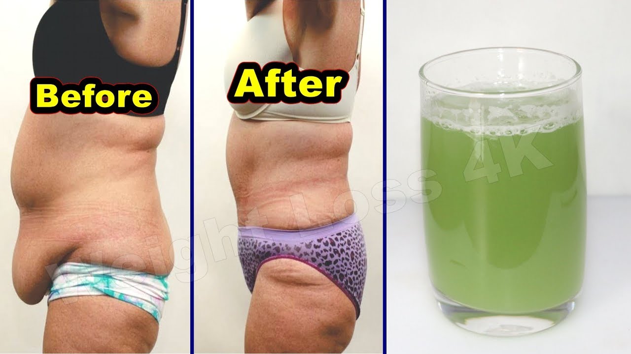How to Lose Belly Fat in Just 10 Days Get a flat belly at home || My Simple Remedy - YouTube