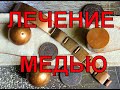 Медь - лечение суставов, мигрени и других болезней.