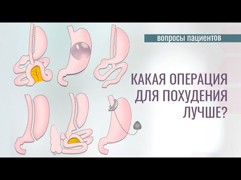 Видео: Карл Марковиц: биография, кариера, личен живот