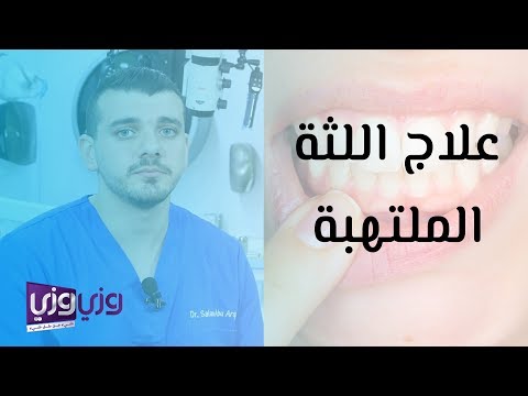 علاج اللثة الملتهبة