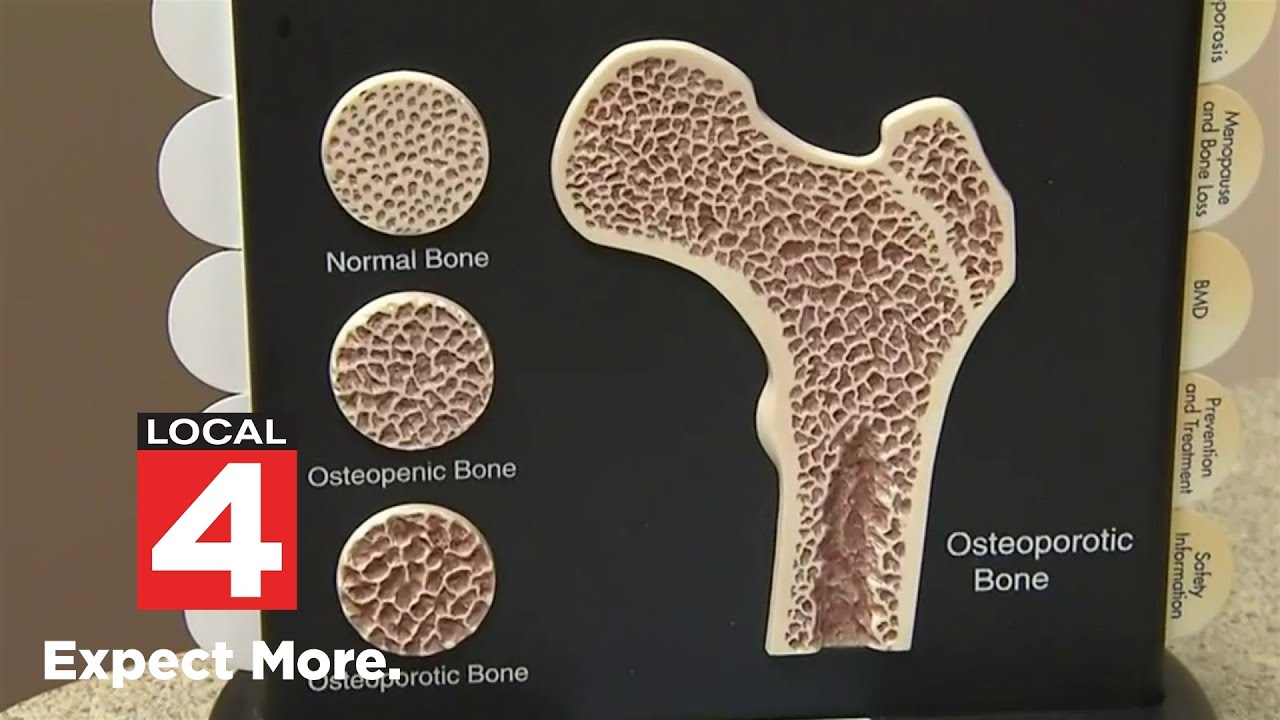 How to keep bones strong at any age - YouTube