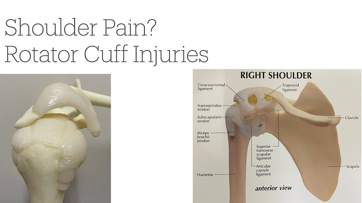 Best Info on ROTATOR CUFF TEARS & SHOULDER PAIN