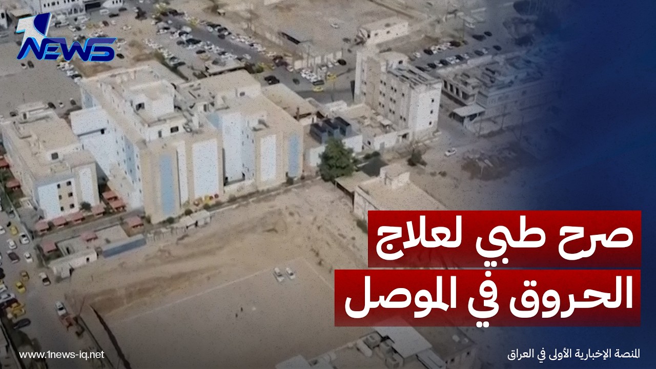 مشروع طبي جديد في الموصل.. مستشفى متخصص لعلاج الحروق بدعم خيري