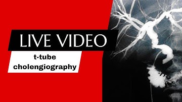 t-tube cholangiography procedure @radiologytechnologistamir @RadiologyClasses @MicroStrategy_US_2023.