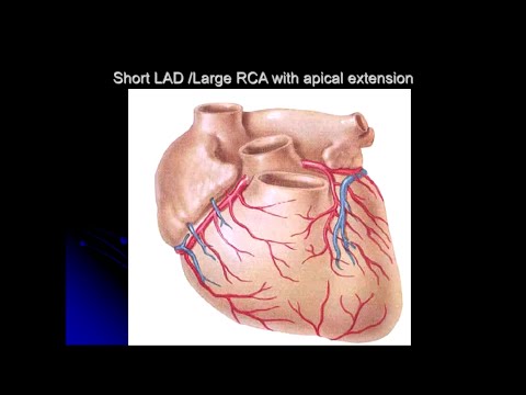 Video: Làm thế nào để khôi phục từ một Angiogram (với Hình ảnh)