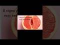 LISTEN TO YOUR BODY: EIGHT (8) SIGNS THAT YOUR VAGINA IS INFECTED AND MAY NEED ATTENTION