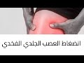 الم حارق في الفخذ شرح مفصل لمرض انضغاط العصب الجلدي الفخذي