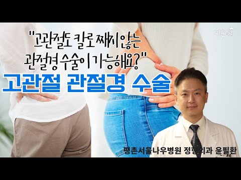 고관절(엉덩이 관절)도 <strong>칼도</strong> 째지 않는 관절경 수술이 가능해요? 고관절 관절경 수술(평촌서울나우병원 정형외과 윤필환)