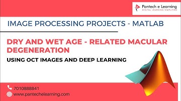 DRY AND WET AGE-RELATED MACULAR DEGENERATION USING OCT IMAGES AND DEEP LEARNING