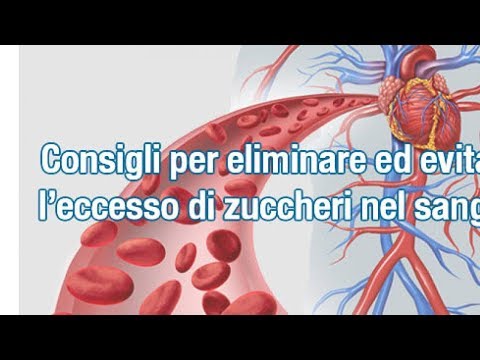 Consigli per regolare