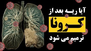 خبرهای مهم برای آنها که کرونا گرفته اند