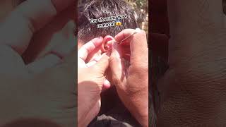 ear cleaning wax removal 😱 #viralreels #viralvideo #earwax #earwaxremoval