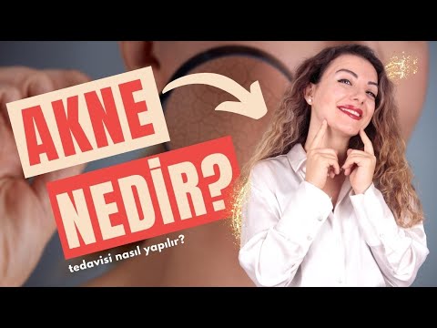 Akne nedir tedavisi nasıl yapılır ? Doç. Dr. Ezgi Özkur  |  Quartz Clinique