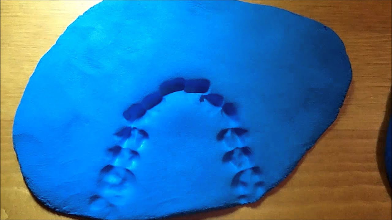 Does Invisalign Make a Good Impression? YouTube