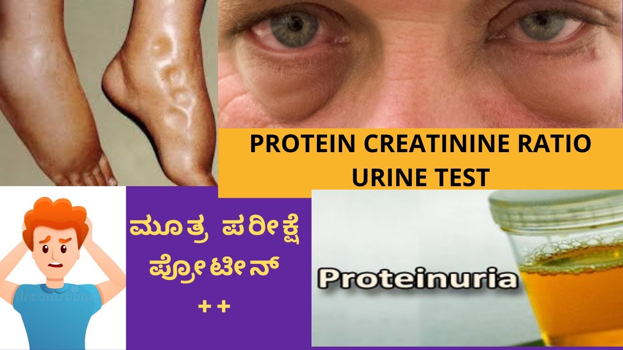 URINE PROTEIN CREATININE RATIO TEST WHEN IS IT DONE UNDERSTAND THE